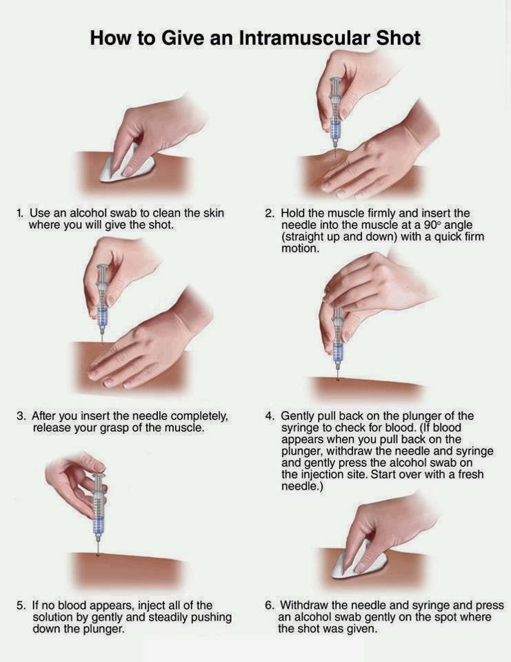 Как сделать укол: пошаговая инструкция как сделать правильно в домашних условиях инъекцию